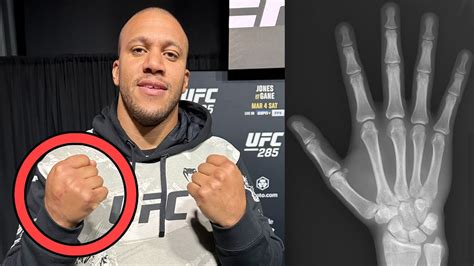 ‘Everything is perfect’ — Ciryl Gane addresses broken hand .